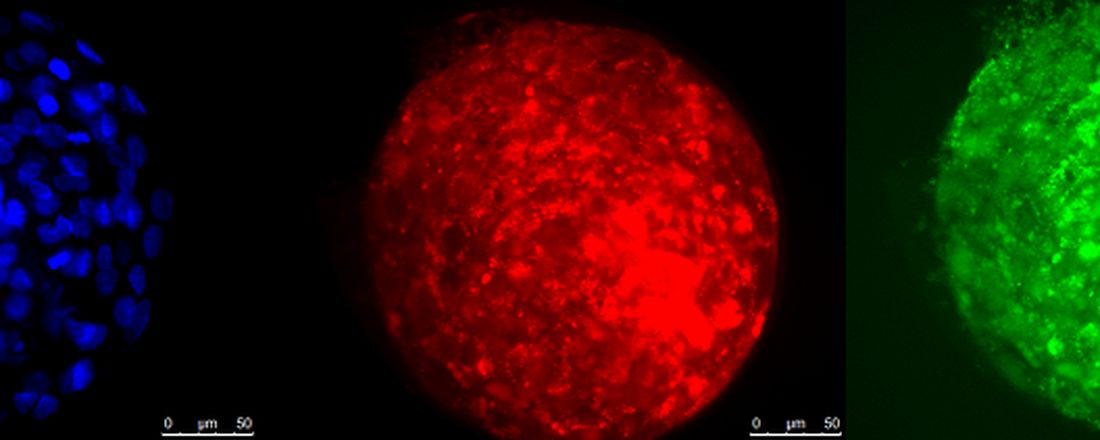 Nanotecnologia e Nanomedicina do Ferro