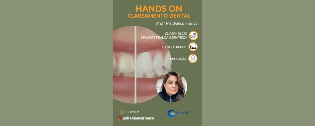 CURSO: HANDS ON CLAREAMENTO DENTAL