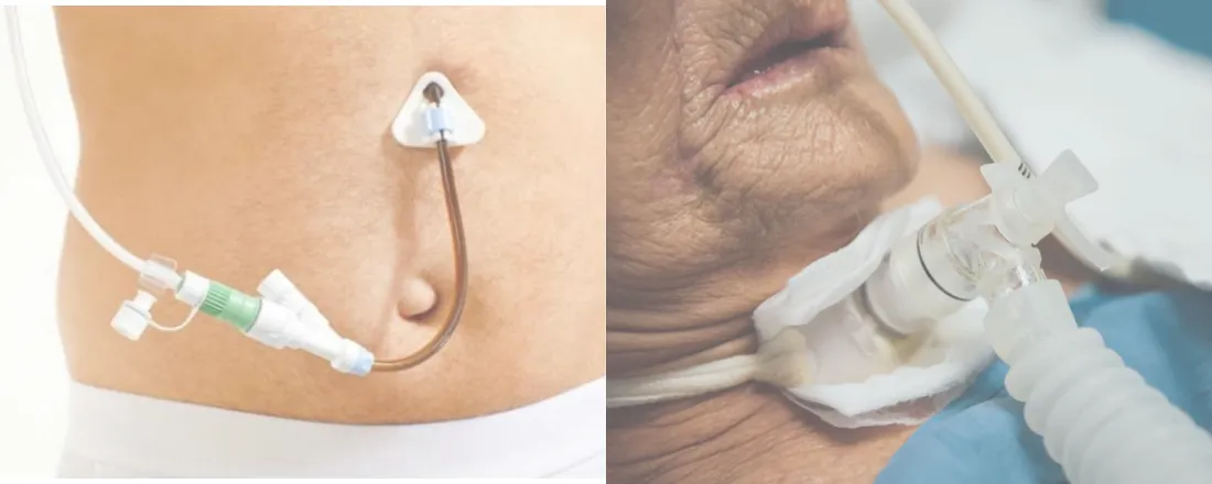 DISPOSITIVOS GTT, TQT E BOMBA INFUSORA - Turma 12