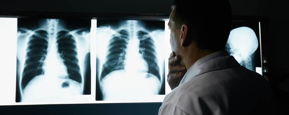 Câncer de Pulmão em Não Tabagistas