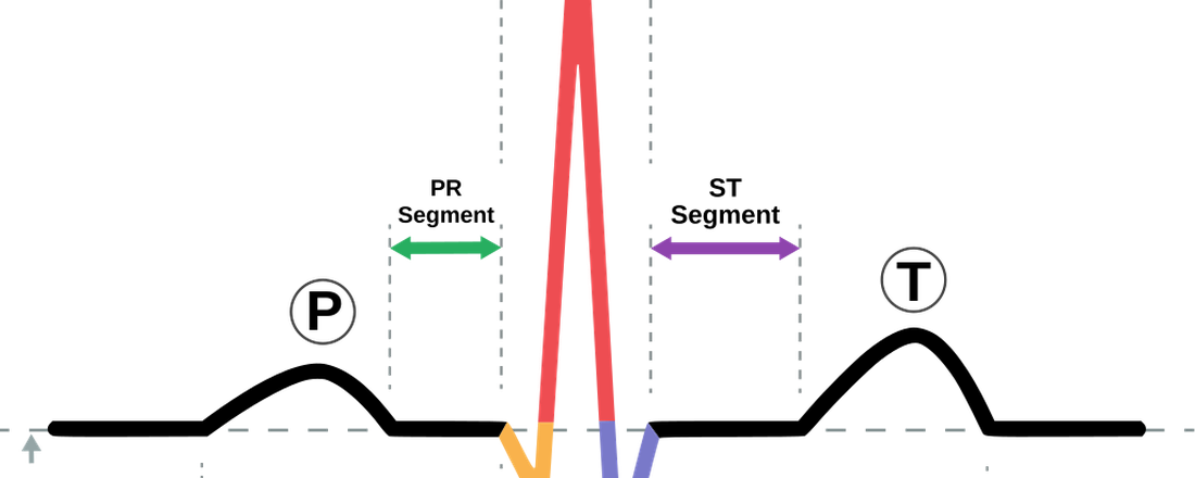 INTERPRETAÇÃO DE ELETROCARDIOGRAMA