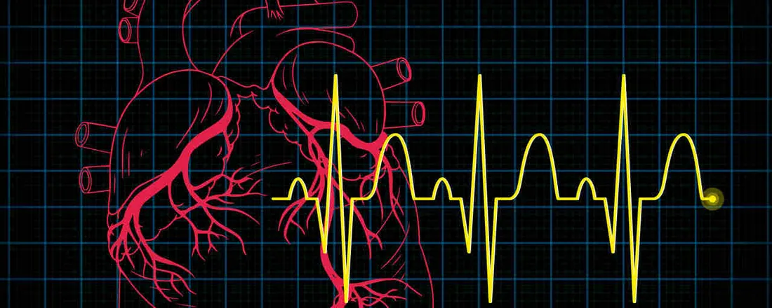 Interpretação Clínica do Eletrocardiograma