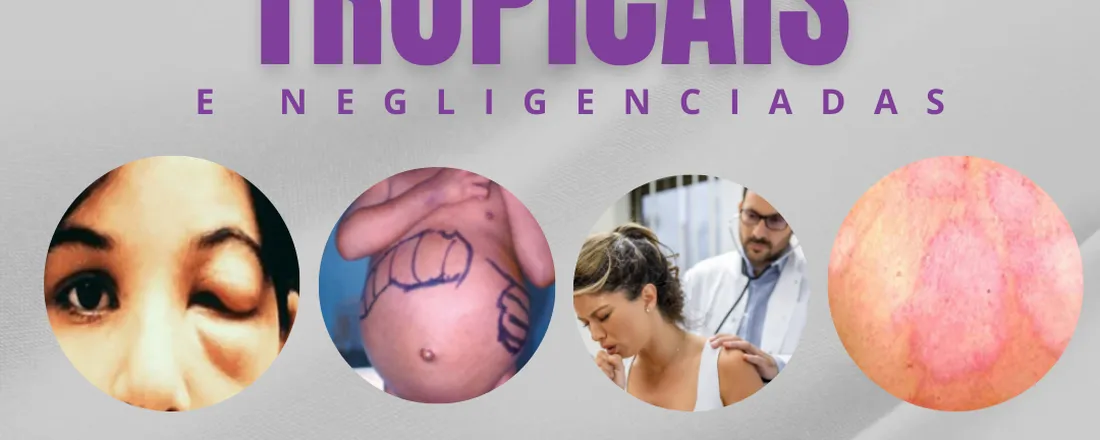 I SIMPÓSIO DE DOENÇAS TROPICAIS E NEGLIGENCIADAS DA UNINASSAU CARUARU