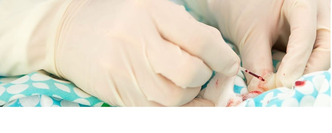 Cateterismo Umbilical 10032020