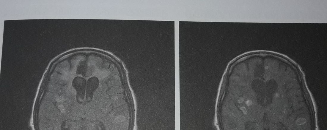 Curso de Extensão em Psicofarmacologia.