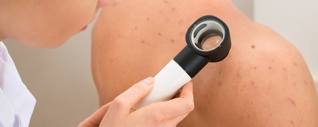 Câncer de Pele Não-Melanoma: Uma Visão Interdisciplinar