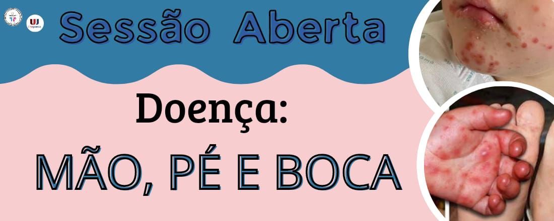 Sessão aberta - Doença de mão, pé e boca