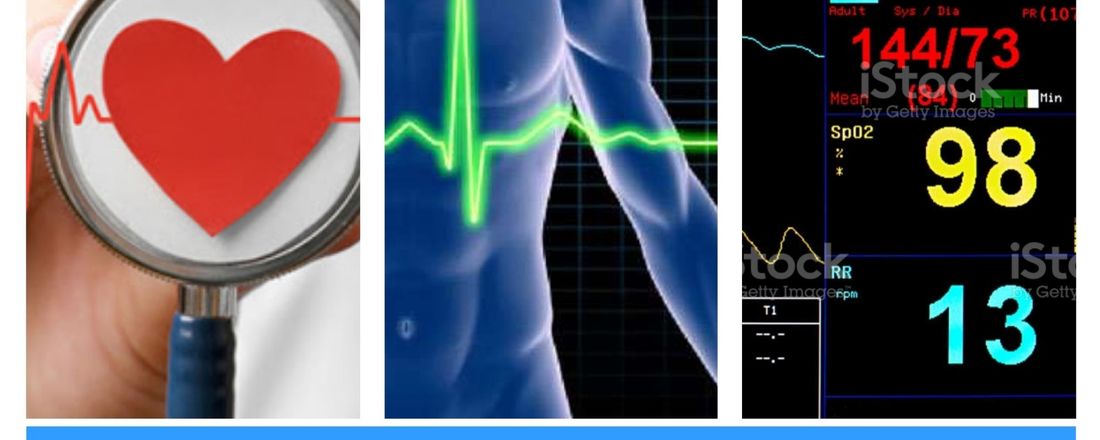 ECG Descomplicado