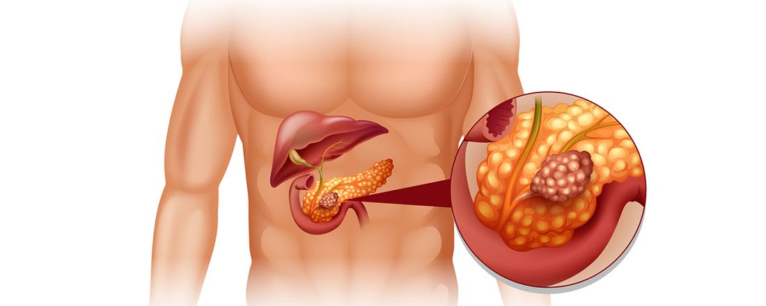 METABOLISMO DA GLICOSE - INTERPRETAÇÃO DE EXAMES LABORATORIAIS E CONDUTA NUTRICIONAL