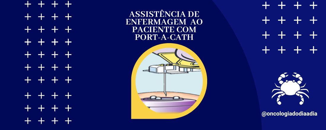 Assistência de Enfermagem ao Paciente com Port-a-Cath