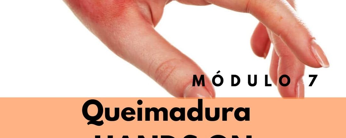 MOD6 - QUEIMADURAS