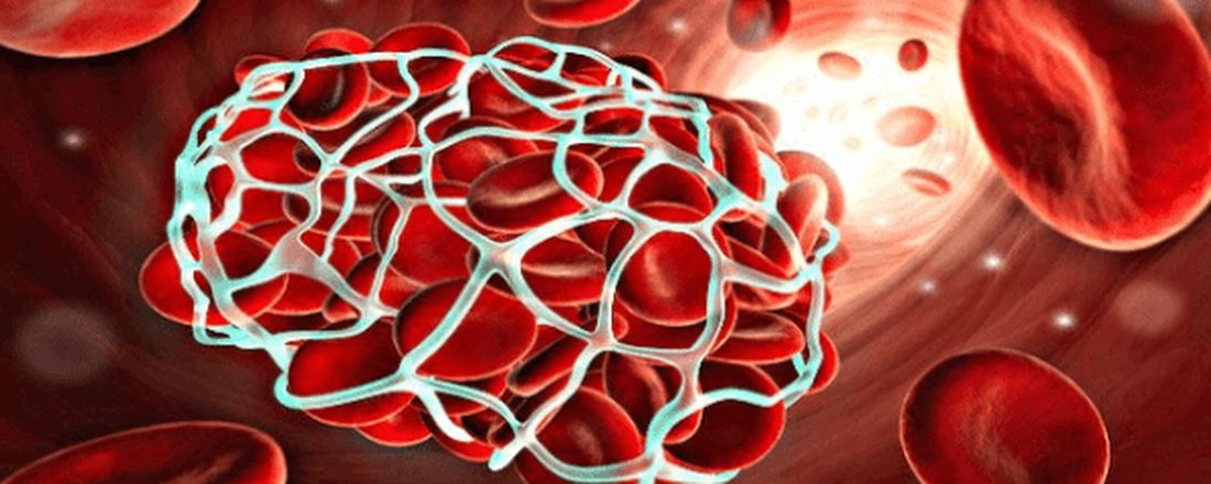 Treinamento: Controle de Sangramento para Cirurgia Segura