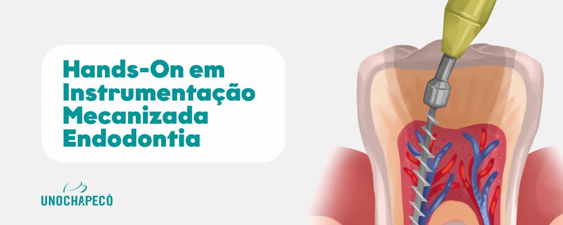 HANDS-ON EM INSTRUMENTAÇÃO MECANIZADA  ENDODONTIA