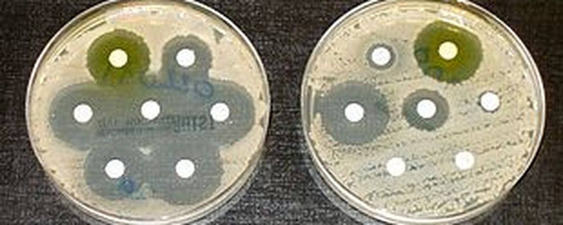 O LABORATÓRIO DE MICROBIOLOGIA CLÍNICA NA DETECÇÃO DE MECANISMOS DE RESISTÊNCIA BACTERIANA