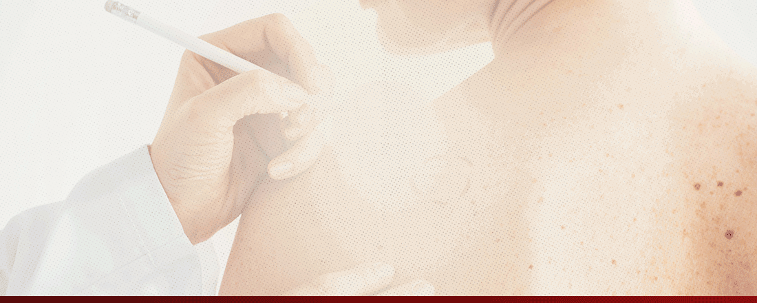 Revista Brasileira das Ligas Acadêmicas de Dermatologia