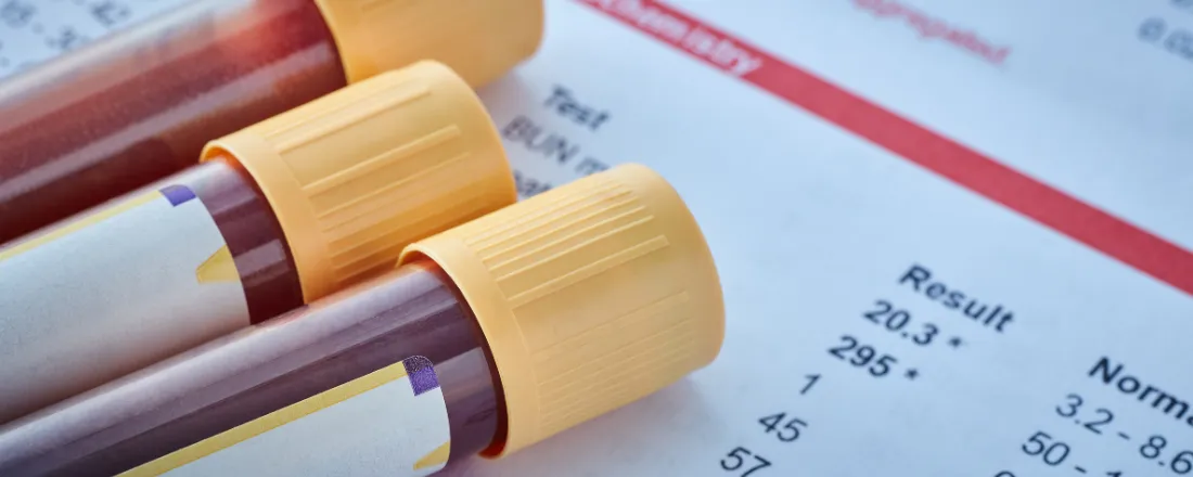 PUNÇÃO VENOSA E COLETA A VÁCUO