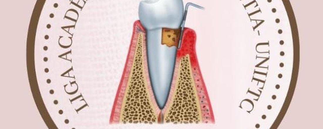 Cirurgia Plástica Periodontal Para Aumento De Coroa Clínica