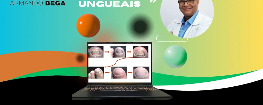 Curso de Órteses Ungueais para Podólogos