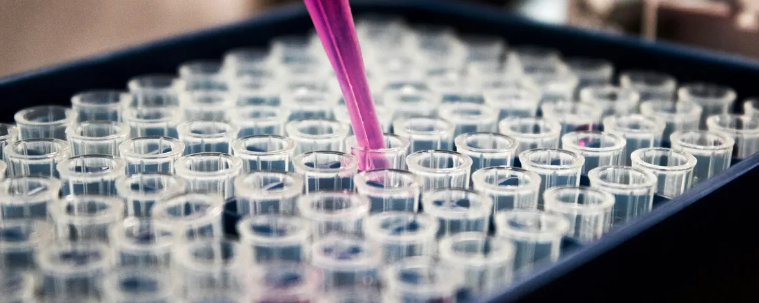 Fundamentos de qPCR para a análise de expressão gênica