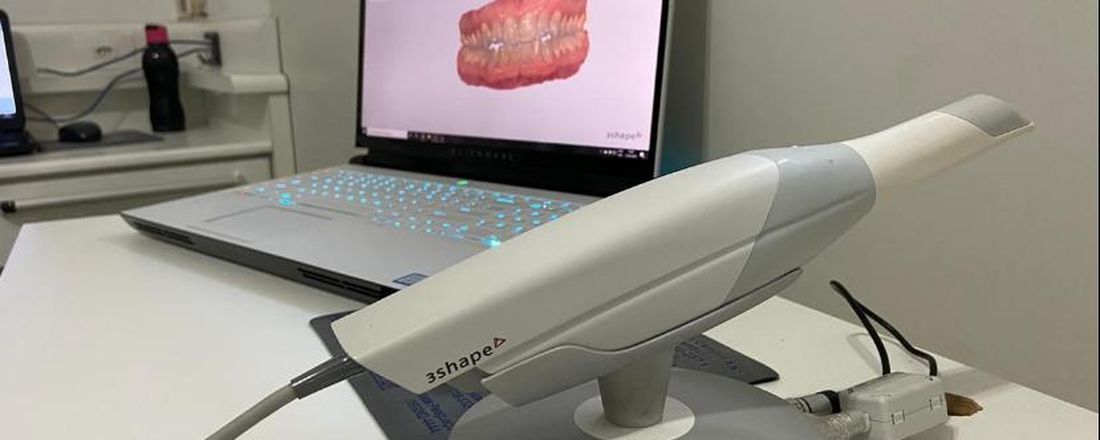 Escaneamento intraoral: possibilidades para o dentista