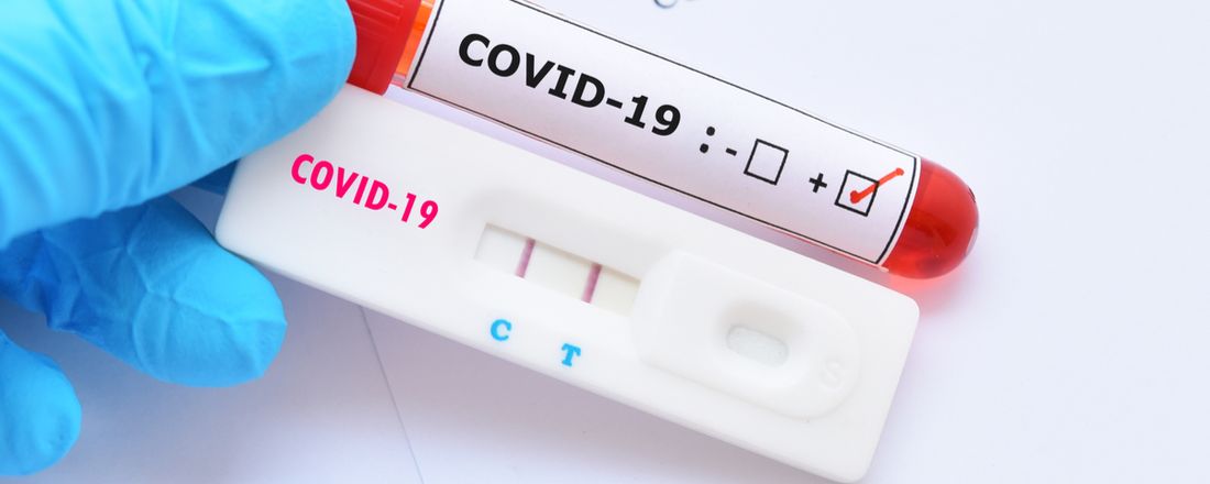 Teste rápido para COVID-19 em Farmácias e Drogarias
