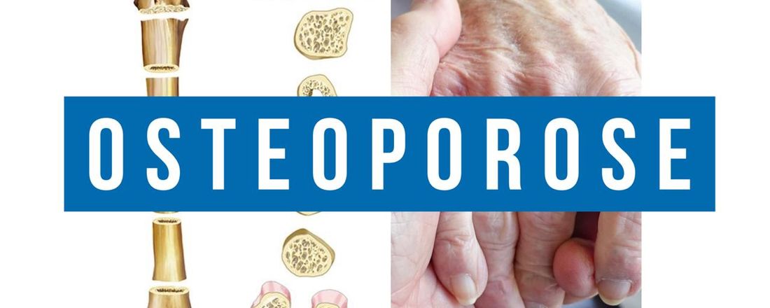 Osteoporose