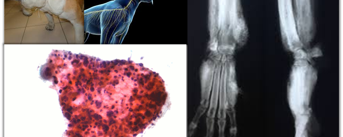 Síndromes Paraneoplásicas: O que são e como diagnosticar