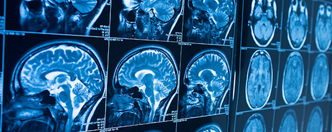 1º Curso online de Emergências Neurológicas