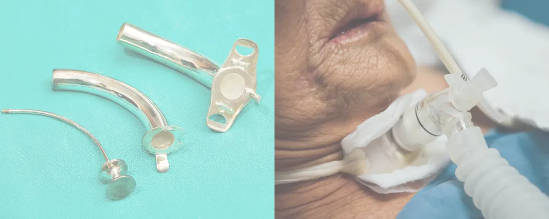 MINICURSO CUIDADOS COM TQT - ADULTO E PEDIATRICO