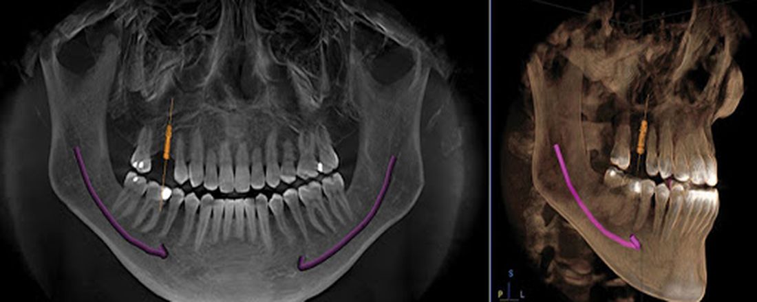 Tomografia odontológica para o clínico