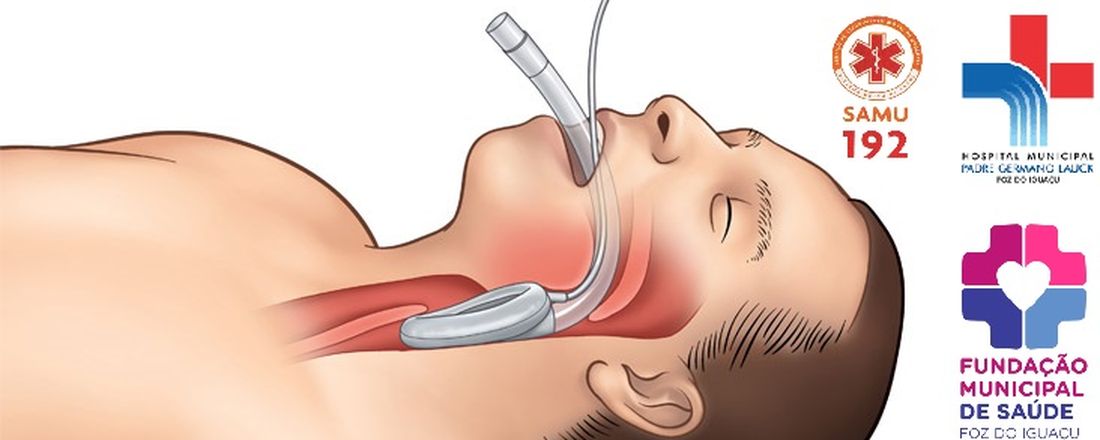 Atuação do enfermeiro na via aérea difícil e Dispositivos extraglóticos